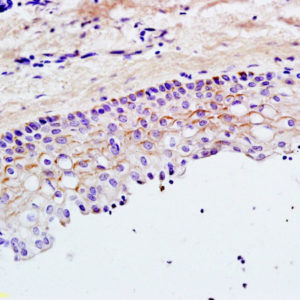 Polyclonal Antibody