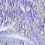 Polyclonal Antibody