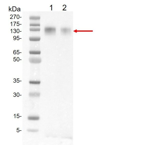 SARS-CoV-2 Spike protein (S1)